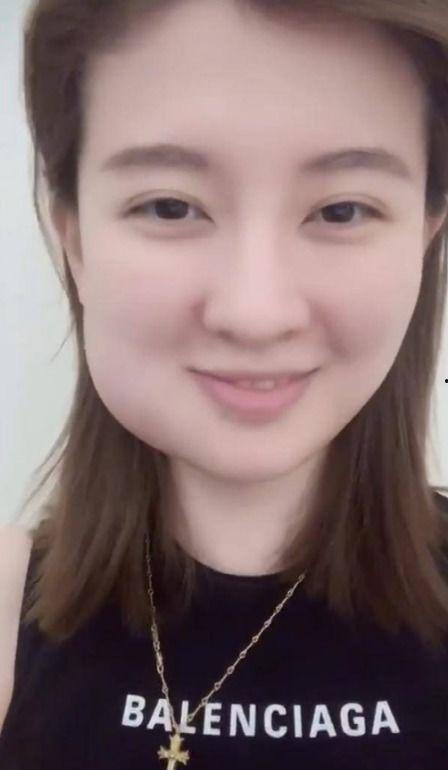明星网红拔智齿视频播放,网友直呼太真实！