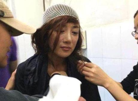 毁容的明星网红有哪些,那些因意外或事故毁容的明星网红